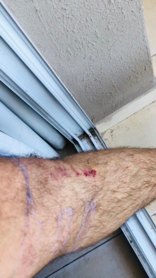 El cantante de NTVG tuvo una noche accidentada en su último show.

No Te Va Gustar (NTVG), tuvo una noche accidentada en el Club Tesioreri durante su presentación en la ciudad de Catamarca. 

Mientras interpretaban "El Camino", los integrantes del grupo saltaban a la par del público pero una sopresa cambió todo.